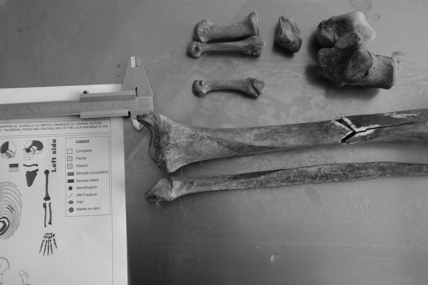 Human bones and fragments on the table at ICMP identification facility in Tuzla.